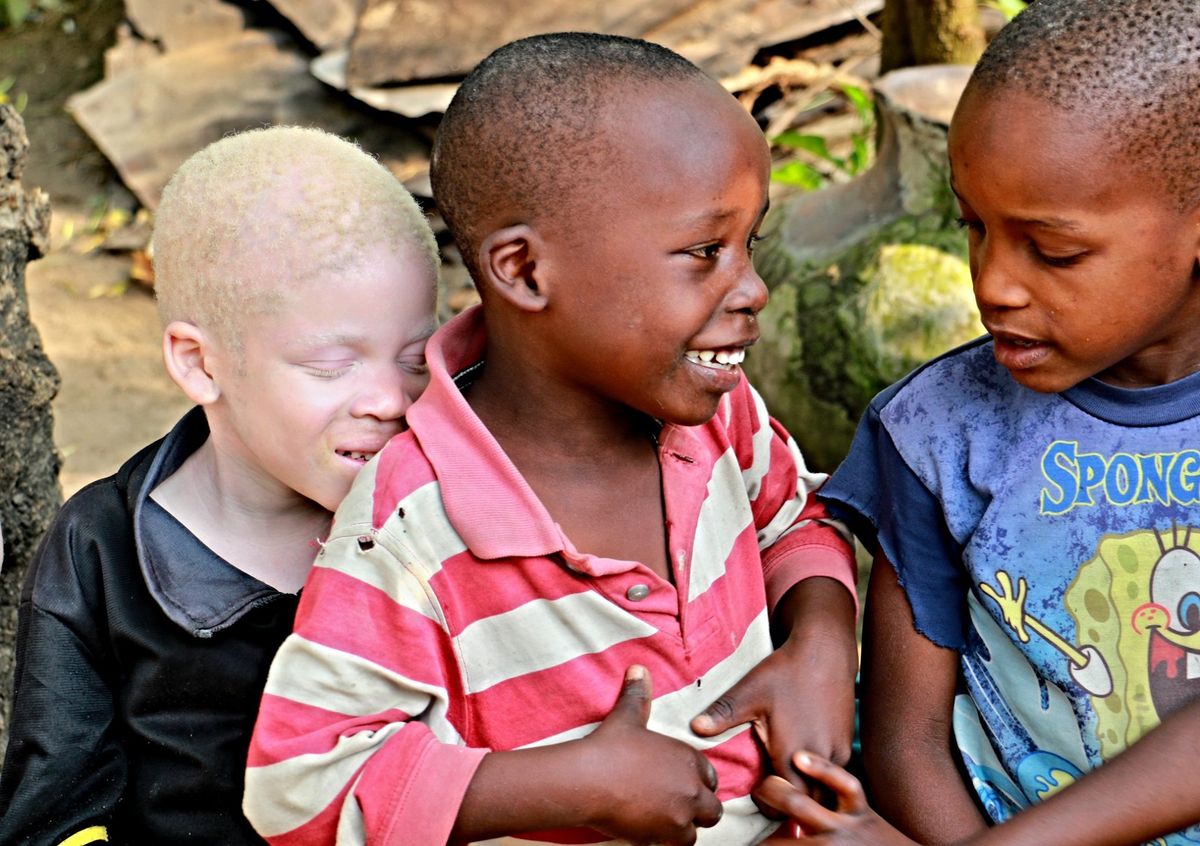 Baraka, az albínó kisfiú, akinek családja a rituális albínó gyilkosságok elől menekült a tanzániai Ukerewe szigetére.