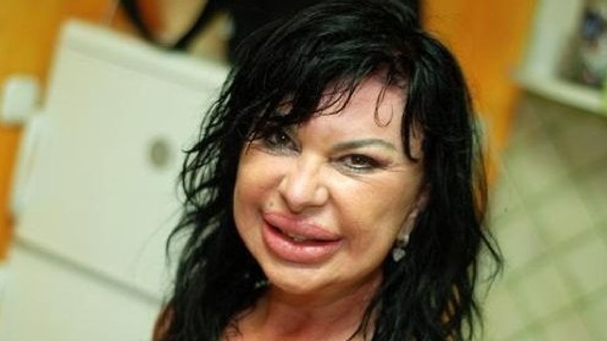 A 12 legrondább plasztikai páciens közt Geronazzo Mária