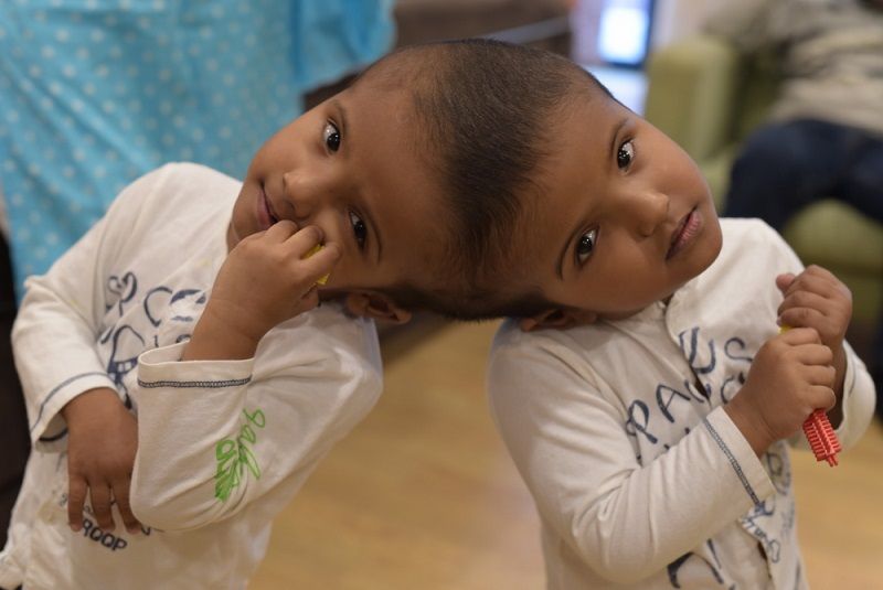 Rabeya (balra) és Rukaya, avagy a bangladesi sziámi ikrek. Fotó: Cselekvés a Kiszolgáltatottakért Alapítvány/Bemer Miklós.