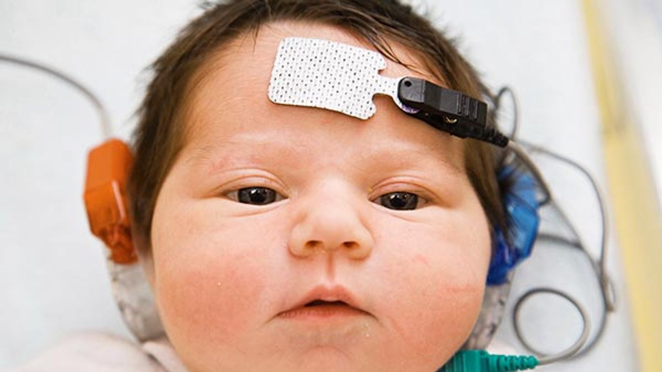 AUDIOMETRY, NEWBORN BABY