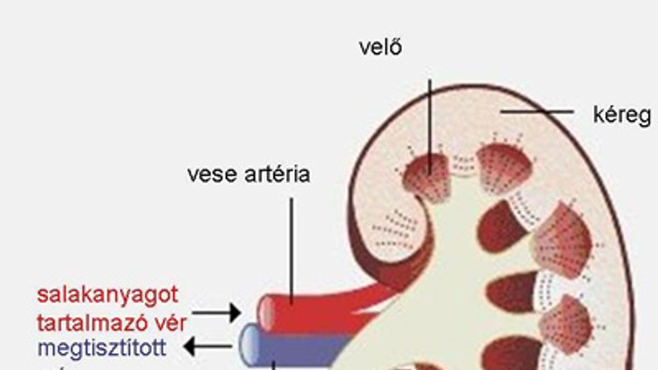 Harcban a krónikus veseelégtelenséggel