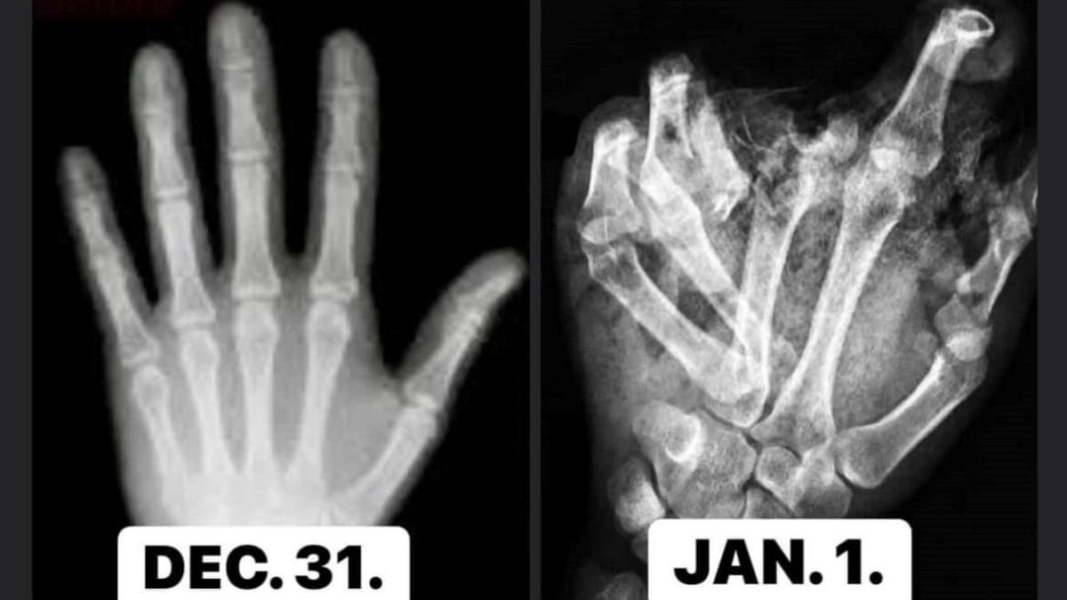 Győrfi Pál mindenkit figyelmeztetett szilveszter előtt