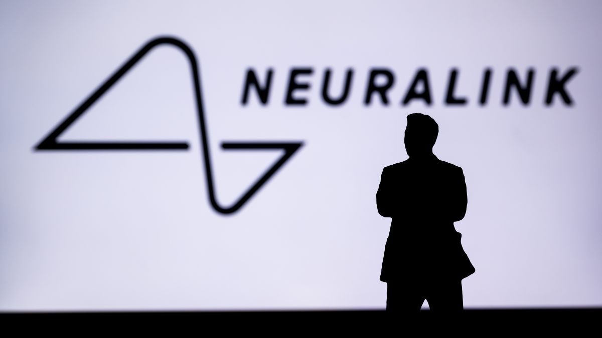 Emberi agyba ültetett be chipet Elon Musk cége