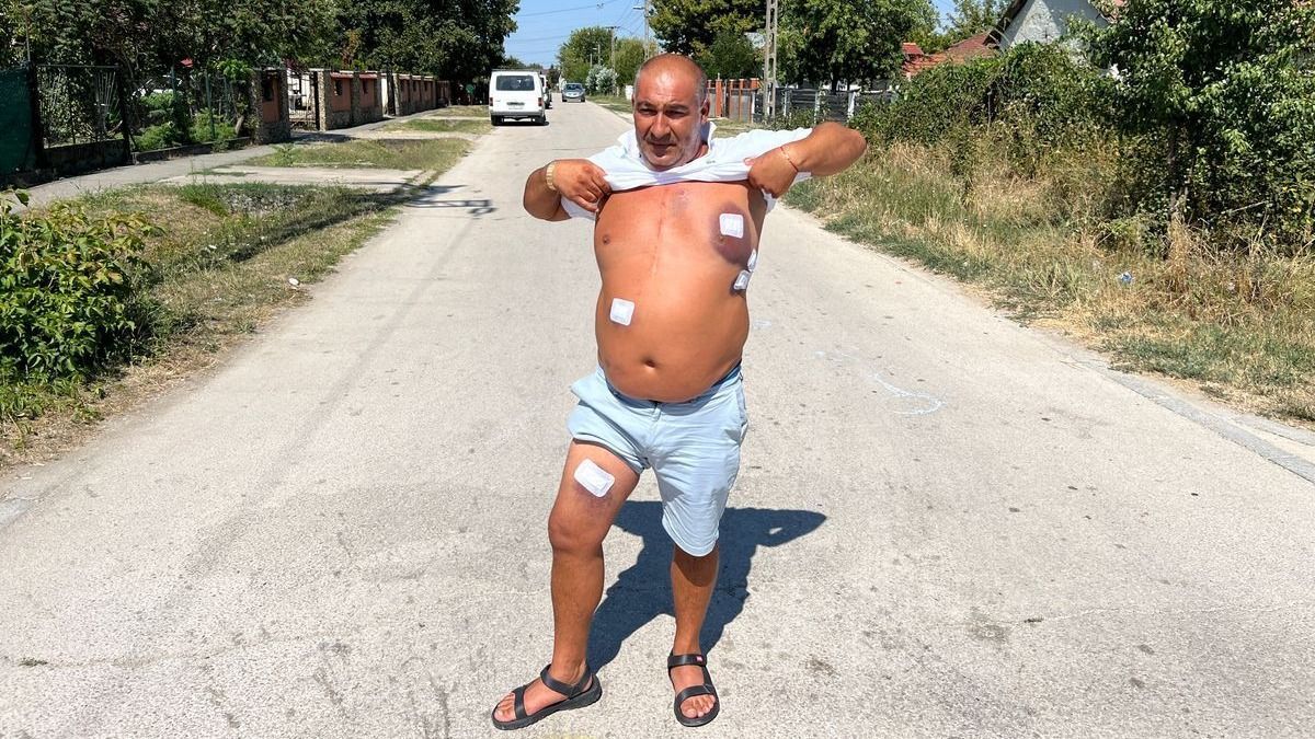 Megszólalt a férfi, akit nyolc helyen lőttek meg Ercsin: Miért jöttetek az öcsém házára?