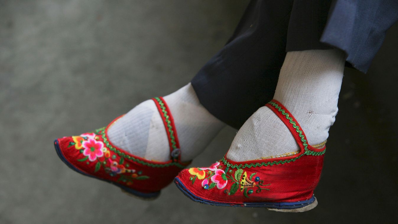 Bound Feet Women In Liuyi Village Of Yunnan Province