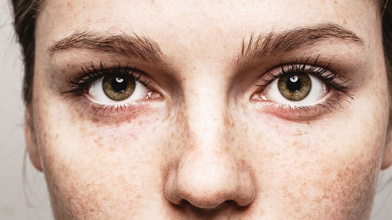 Eyes,Woman,Young,Beautiful,Freckles,Woman,Face,Portrait,With,Healthy