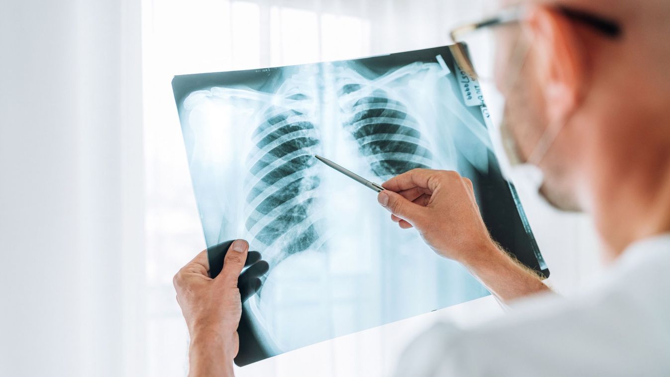 Male,Doctor,Examining,The,Patient,Chest,X-ray,Film,Lungs,Scan