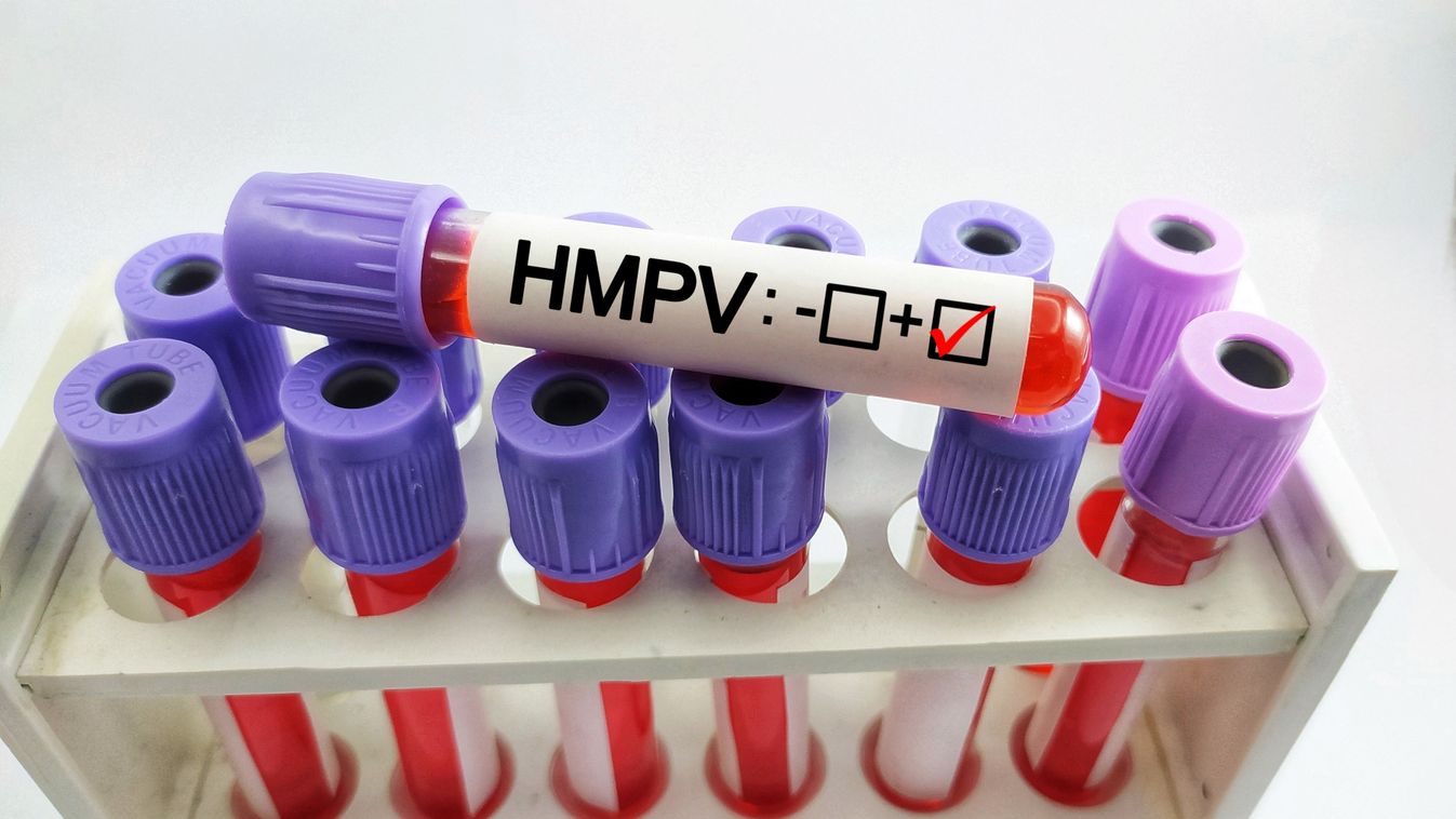 Human,Metapneumovirus,(hmpv),Blood,Test