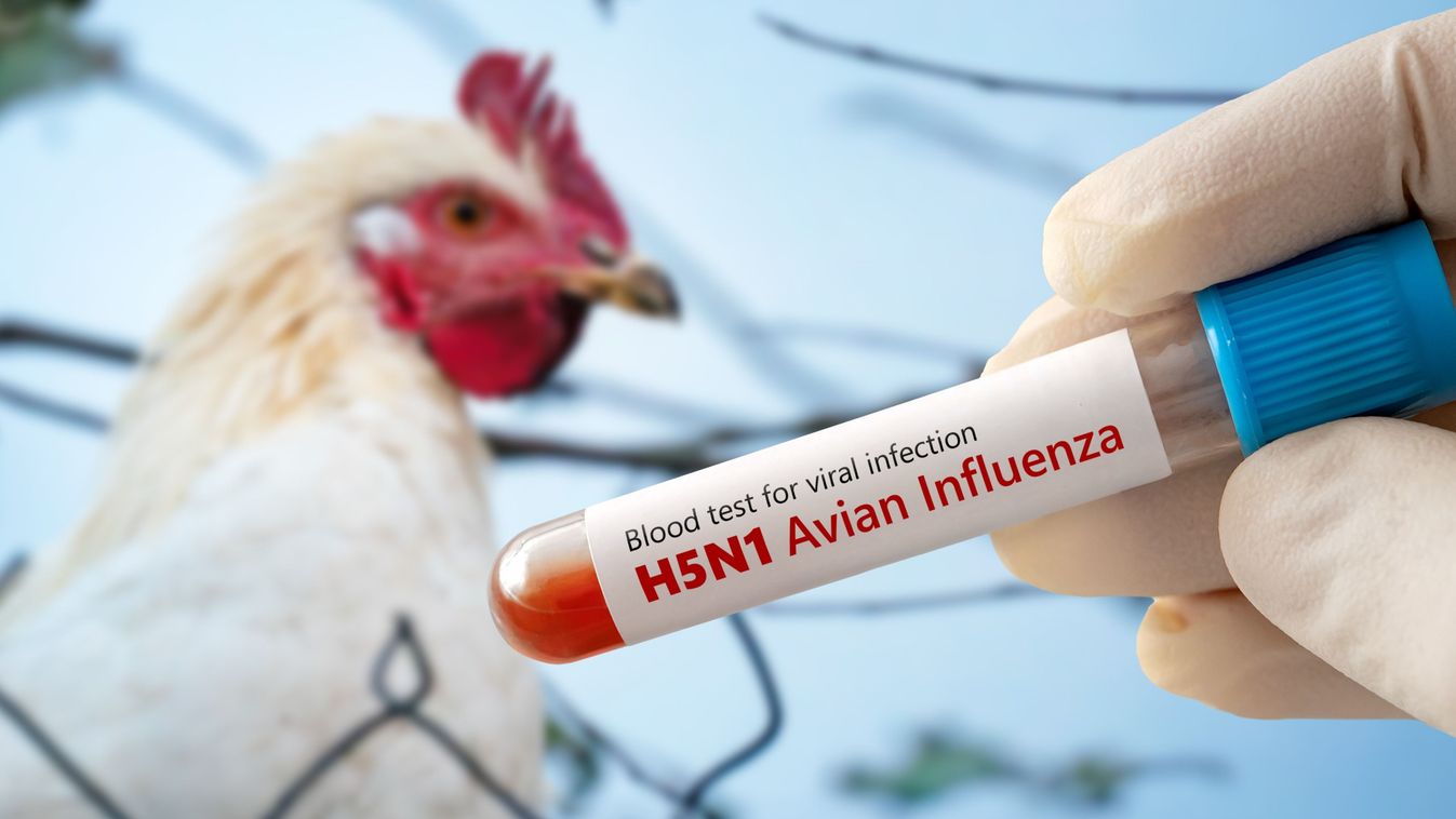 A,Test,Tube,With,A,Blood,Test,For,H5n1,Avian