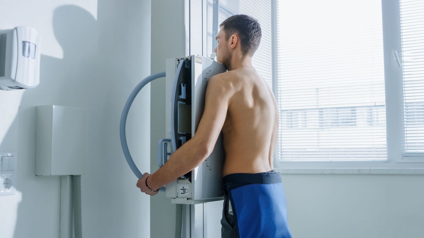 Mellkasröntgen vagy tüdőszűrés?