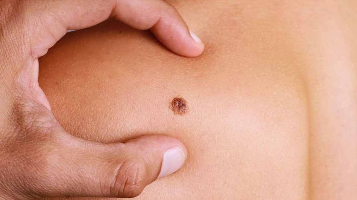 Egy fotón is múlhat az egészségünk – applikáció segít a rosszindulatú daganat korai felismerésében