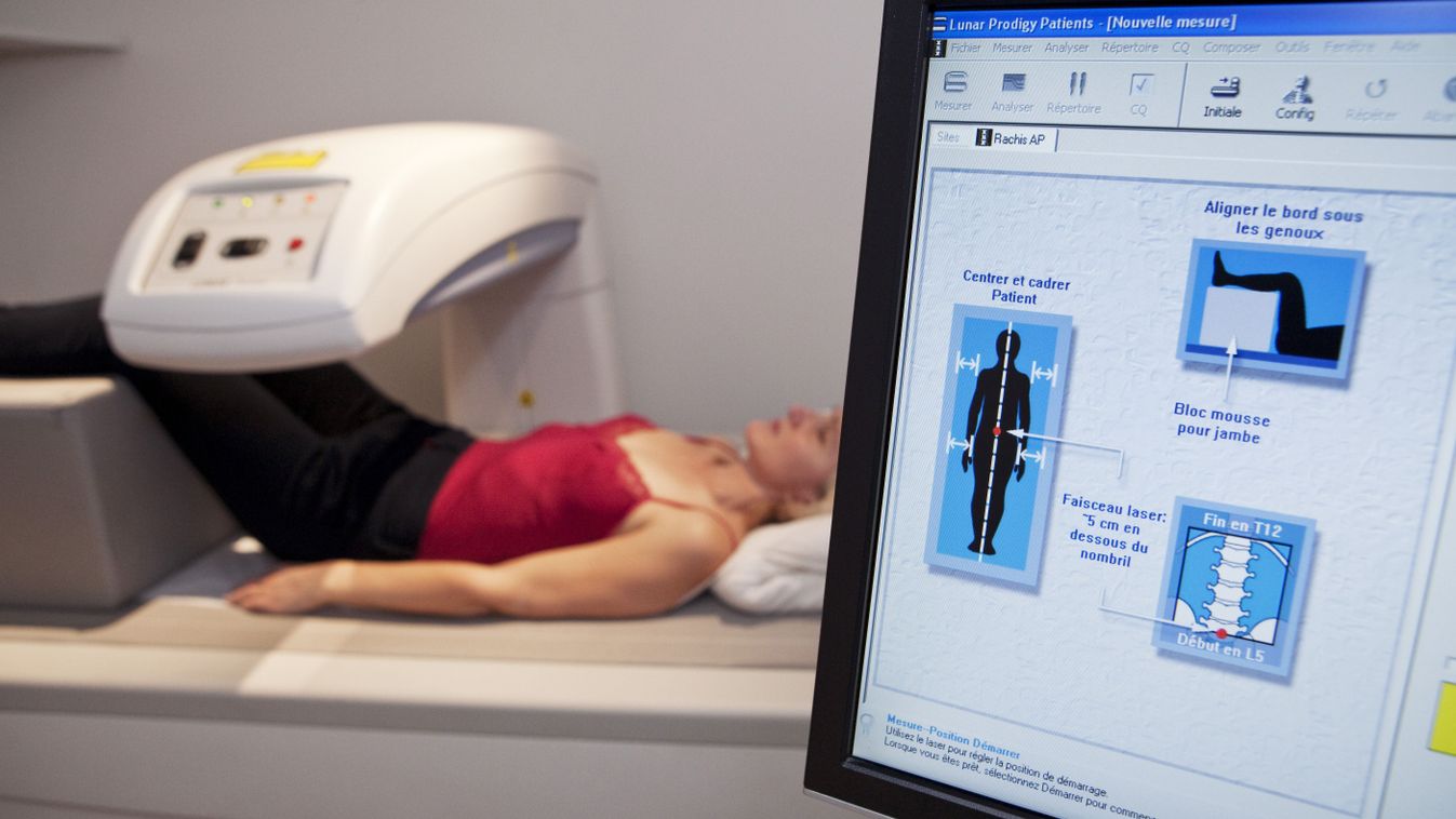 Figyeljen a csontjai egészségére!