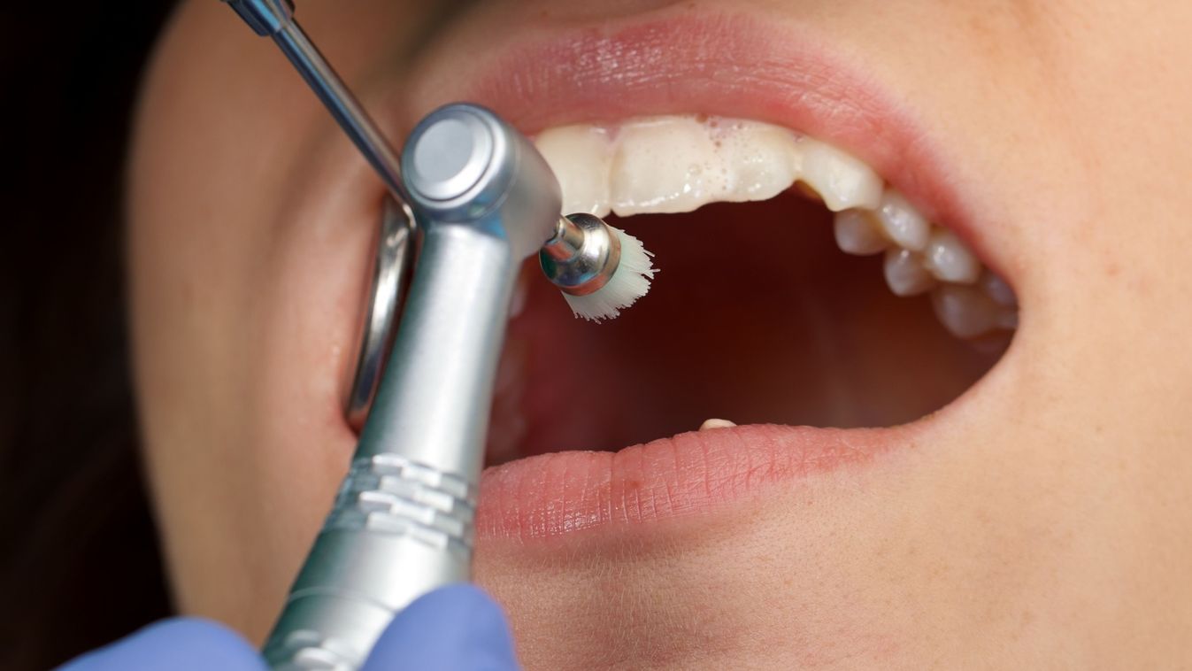 Kíméletes és alapos