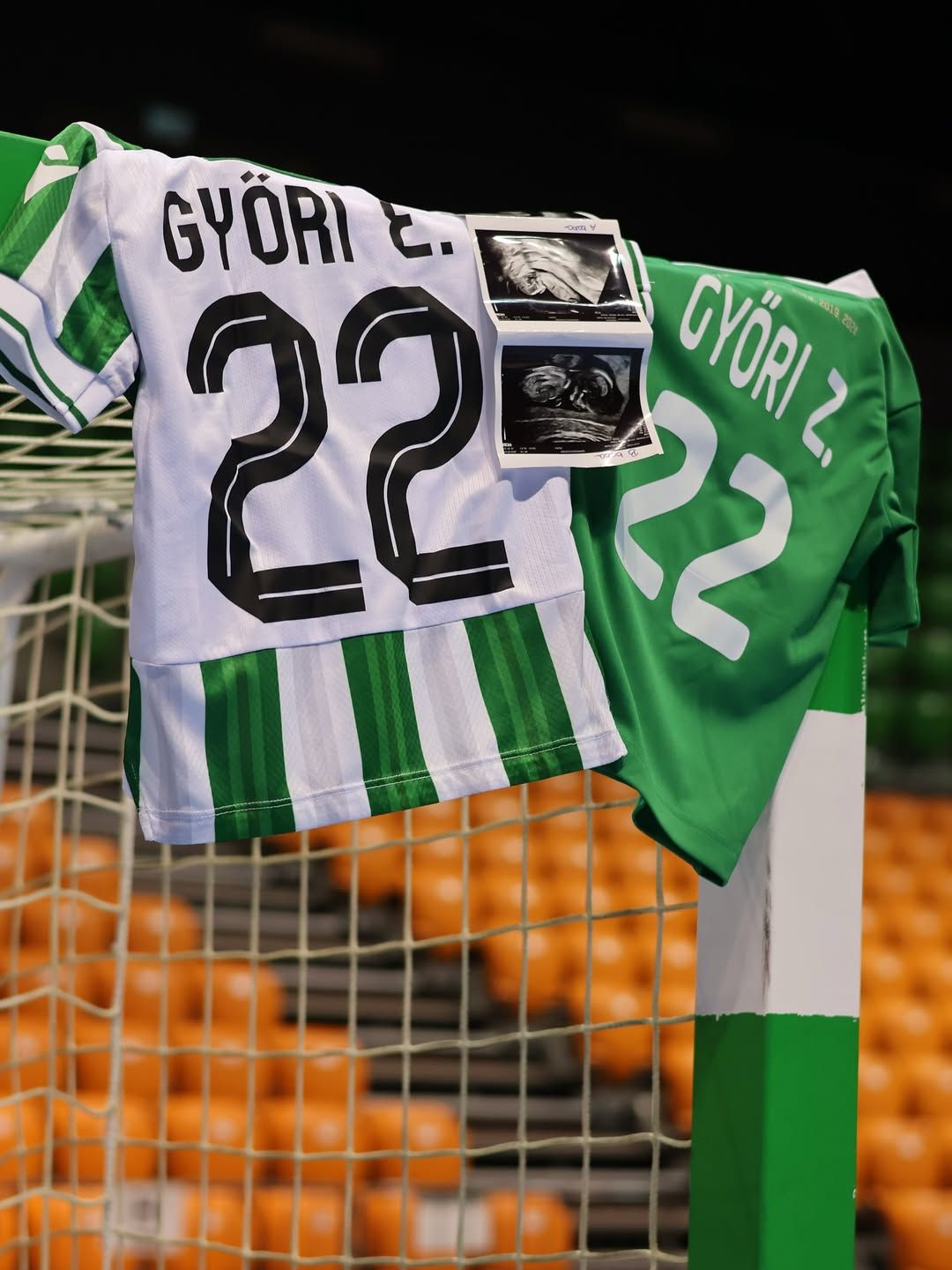 Megszülettek az ikrek, Emma és Zoé