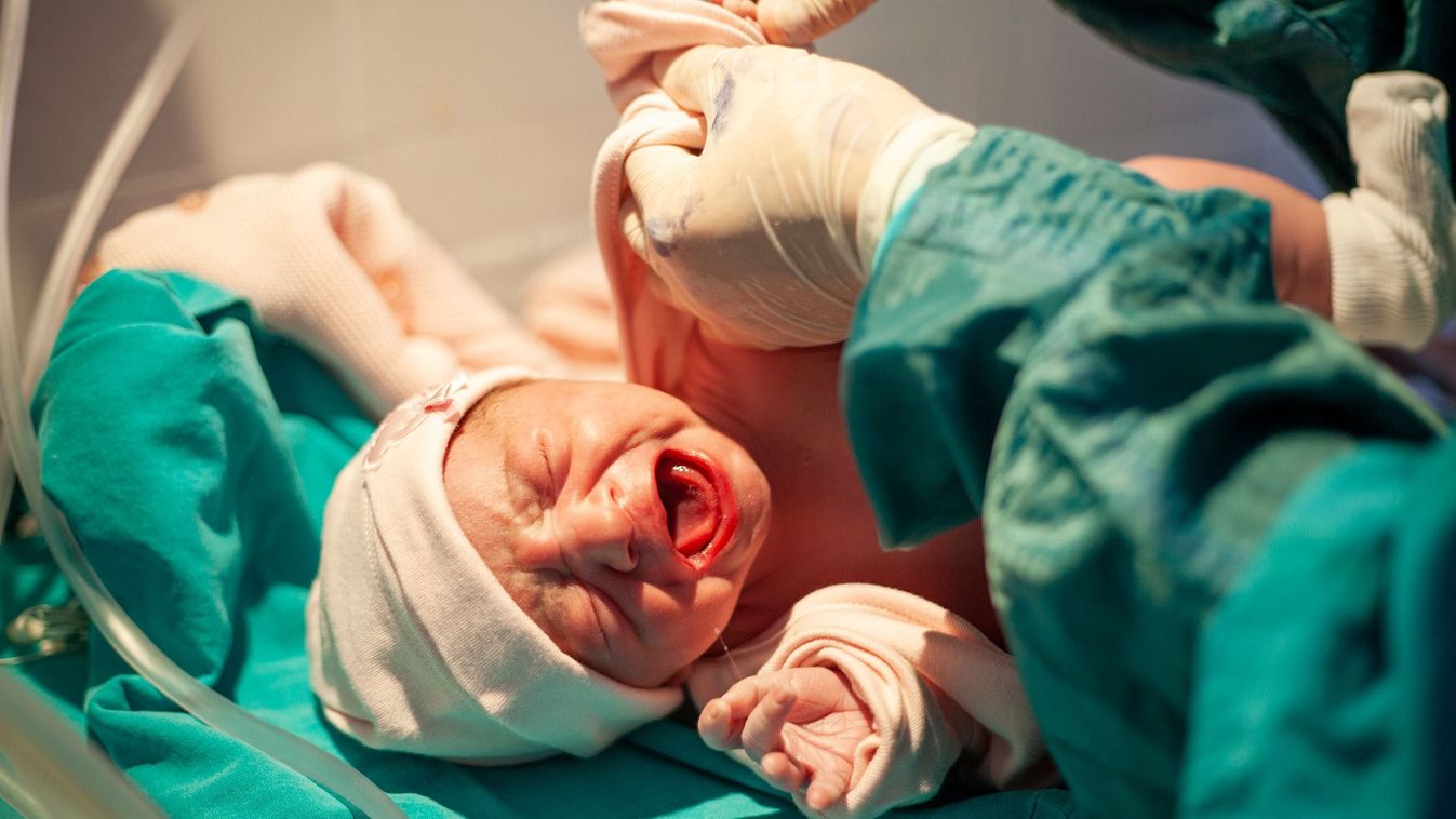 Műtőasztalon született babák