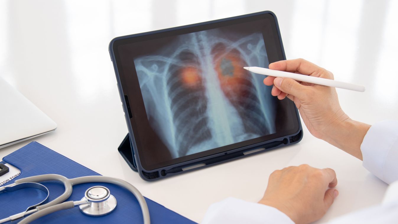 Rendkívüli szűrés indult