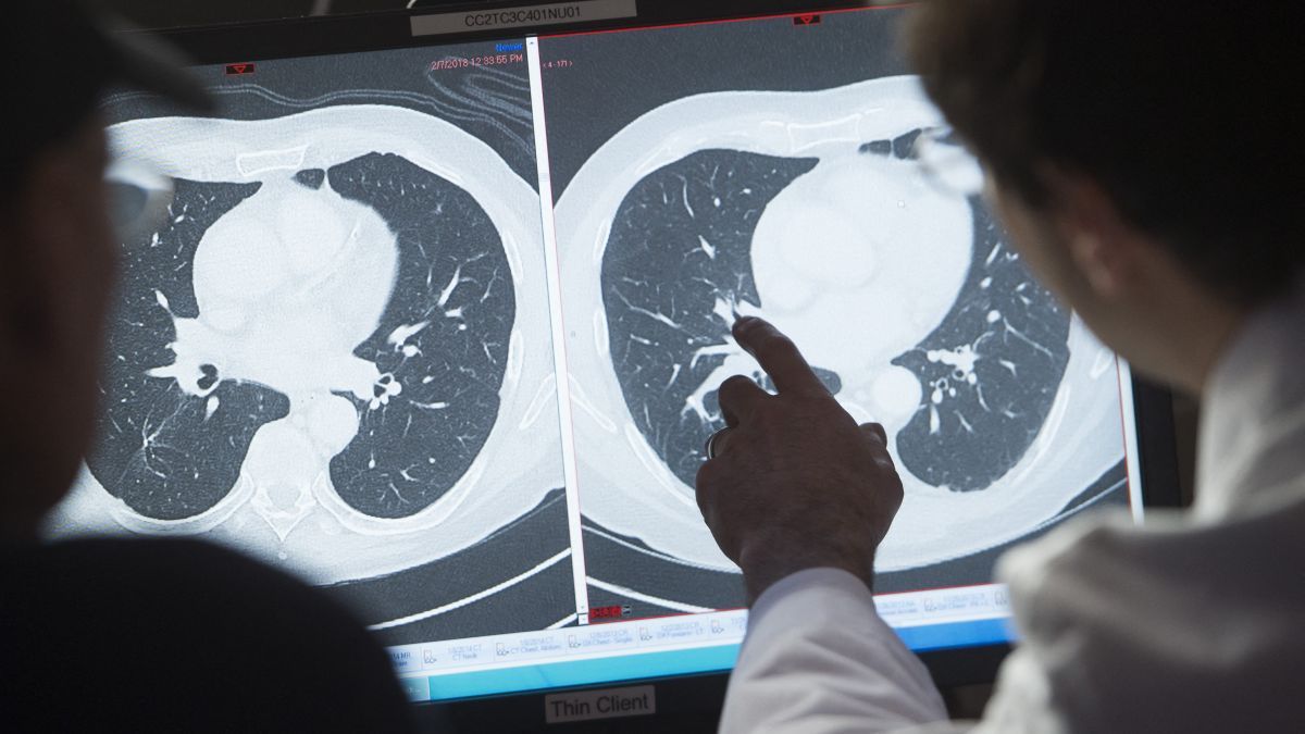 Magyar áttörés: kiderült, min múlik, hogy kinél hat a rákellenes kezelés, és kinél nem