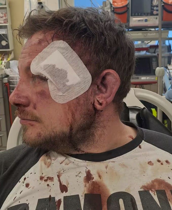 Egy román társaság miatt került kórházba a kisgyermekes apa Berlinben.
