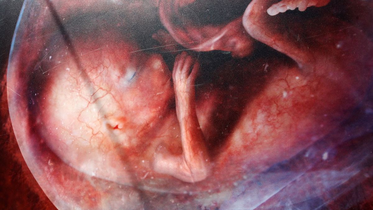 A kései abortusszal kísérleteznek Hollandiában