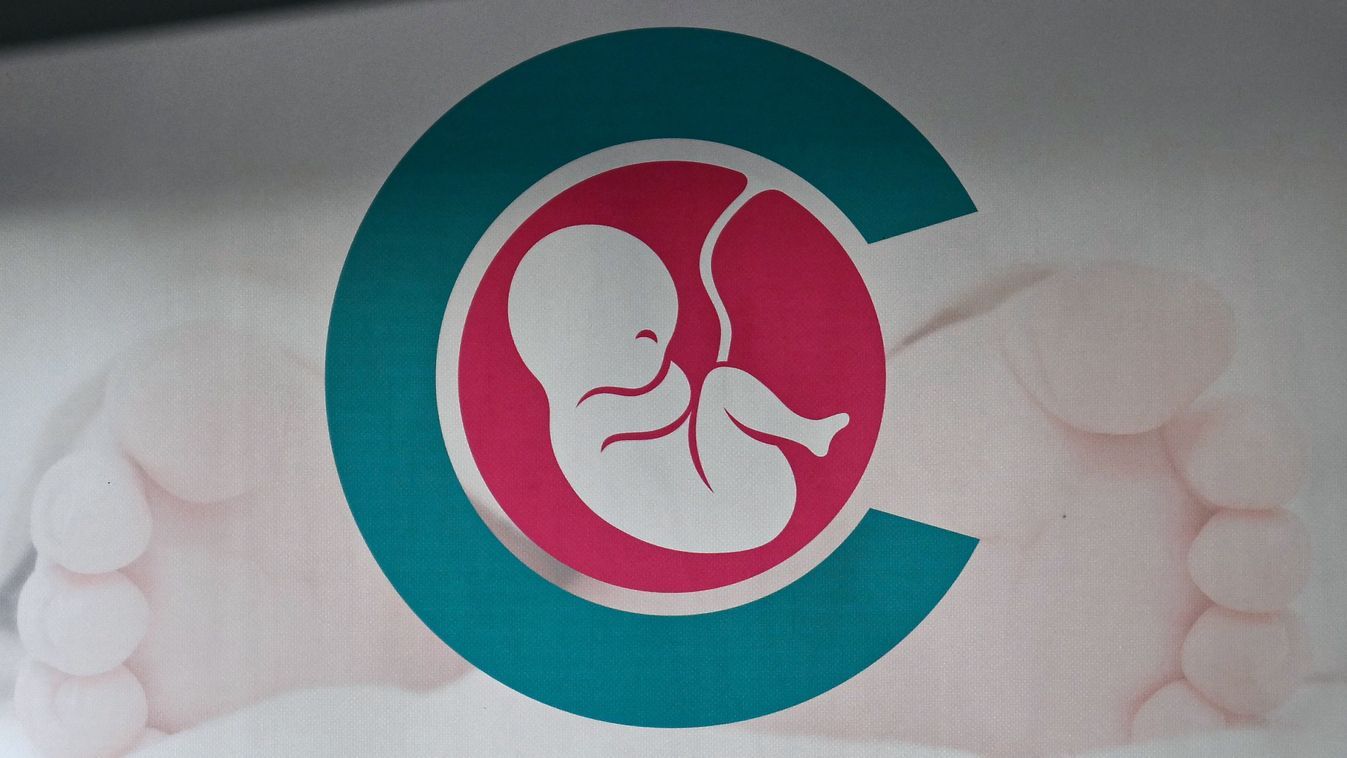 Abortusz